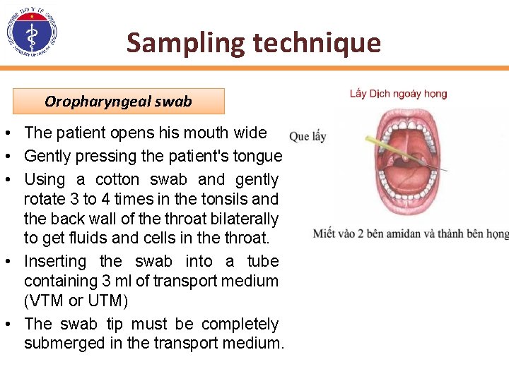 Sampling technique Oropharyngeal swab • The patient opens his mouth wide • Gently pressing