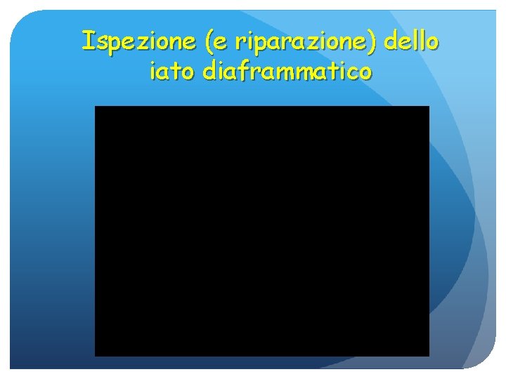 Ispezione (e riparazione) dello iato diaframmatico 