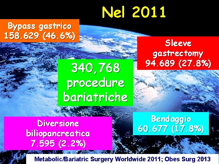 Bypass gastrico 158. 629 (46. 6%) Nel 2011 340, 768 procedure bariatriche Diversione biliopancreatica
