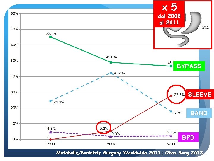 x 5 dal 2008 al 2011 BYPASS SLEEVE BAND BPD Metabolic/Bariatric Surgery Worldwide 2011;