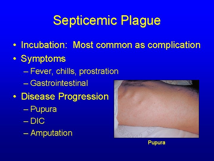 Septicemic Plague • Incubation: Most common as complication • Symptoms – Fever, chills, prostration