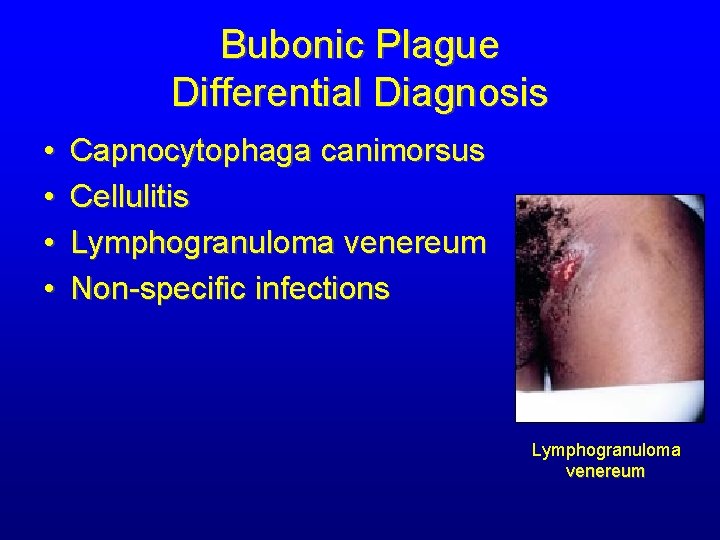 Bubonic Plague Differential Diagnosis • • Capnocytophaga canimorsus Cellulitis Lymphogranuloma venereum Non-specific infections Lymphogranuloma