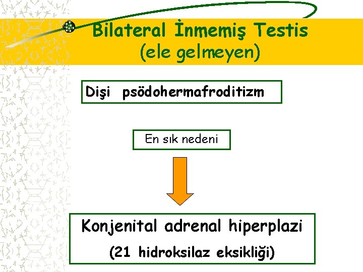 Bilateral İnmemiş Testis (ele gelmeyen) Dişi psödohermafroditizm En sık nedeni Konjenital adrenal hiperplazi (21