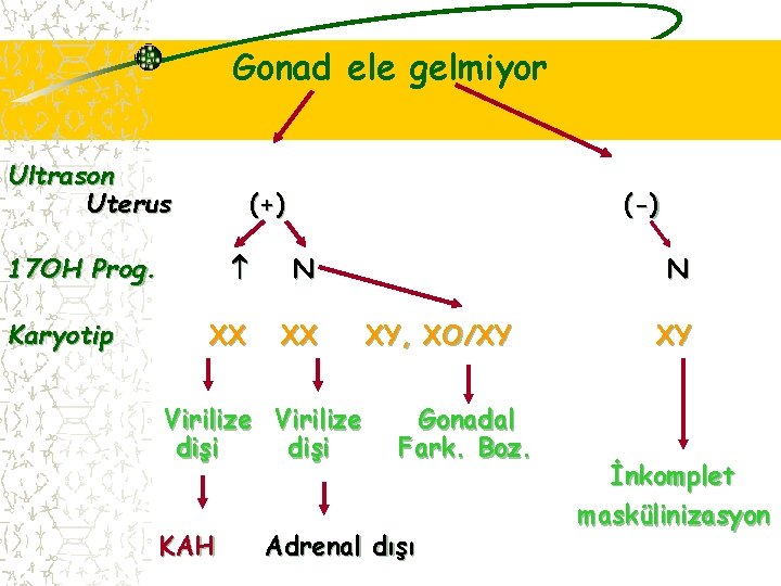 Gonad ele gelmiyor Ultrason Uterus (+) 17 OH Prog. Karyotip (-) N XX XX