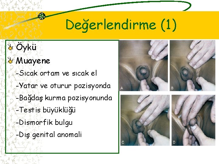 Değerlendirme (1) Öykü Muayene -Sıcak ortam ve sıcak el -Yatar ve oturur pozisyonda -Bağdaş