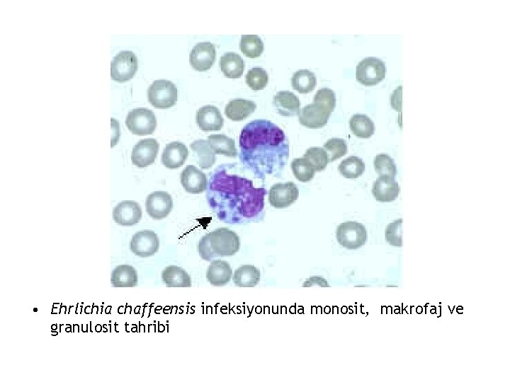  • Ehrlichia chaffeensis infeksiyonunda monosit, makrofaj ve granulosit tahribi 
