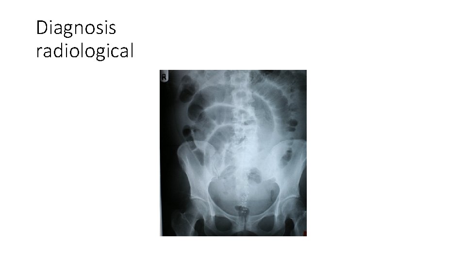 Diagnosis radiological 