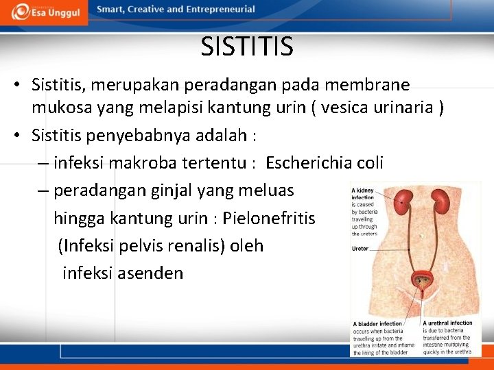 SISTITIS • Sistitis, merupakan peradangan pada membrane mukosa yang melapisi kantung urin ( vesica