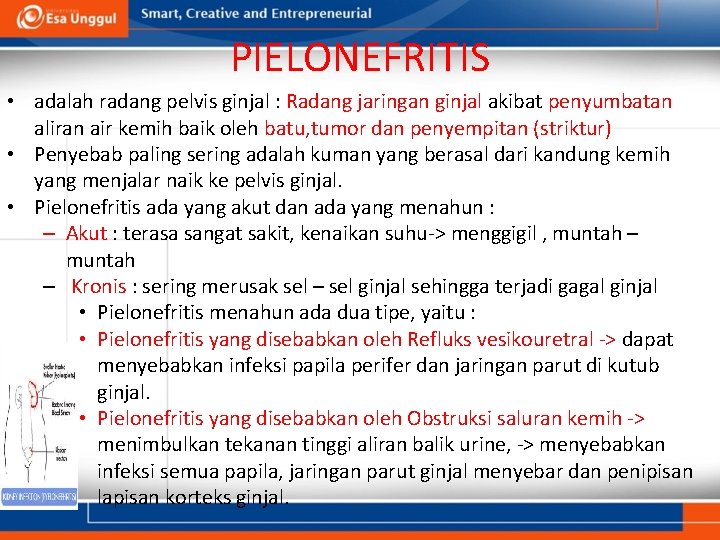 PIELONEFRITIS • adalah radang pelvis ginjal : Radang jaringan ginjal akibat penyumbatan aliran air