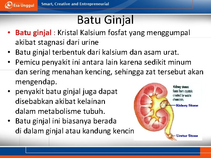 Batu Ginjal • Batu ginjal : Kristal Kalsium fosfat yang menggumpal akibat stagnasi dari