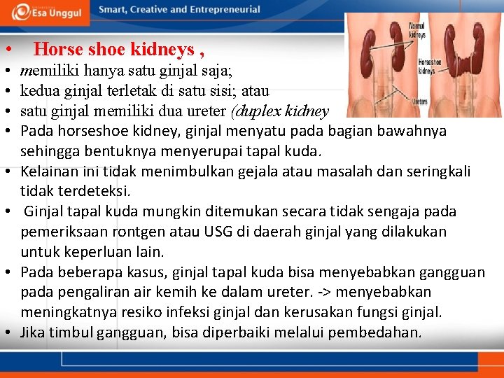  • • • Horse shoe kidneys , memiliki hanya satu ginjal saja; kedua