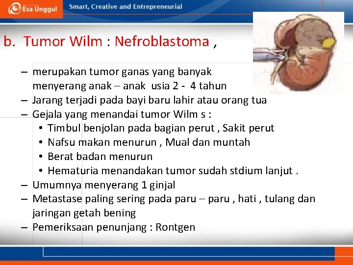 b. Tumor Wilm : Nefroblastoma , – merupakan tumor ganas yang banyak menyerang anak