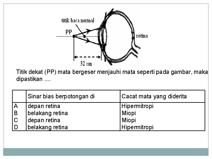 Titik dekat (PP) mata bergeser menjauhi mata seperti pada gambar, maka dipastikan …. A