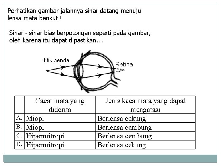 Perhatikan gambar jalannya sinar datang menuju lensa mata berikut ! Sinar - sinar bias