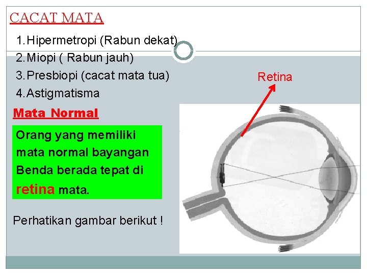 CACAT MATA 1. Hipermetropi (Rabun dekat) 2. Miopi ( Rabun jauh) 3. Presbiopi (cacat