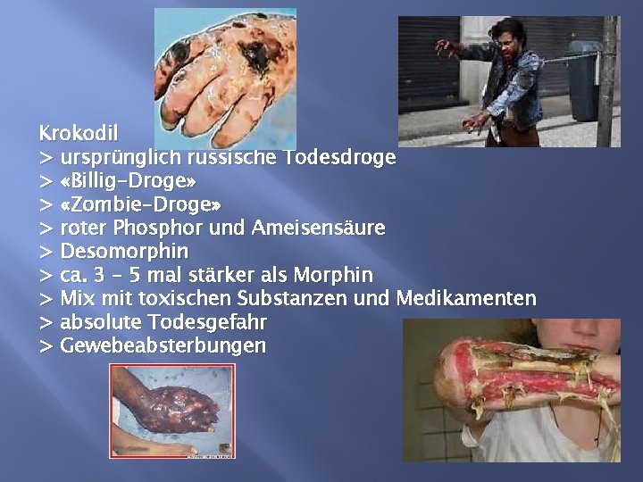 Krokodil > ursprünglich russische Todesdroge > «Billig-Droge» > «Zombie-Droge» > roter Phosphor und Ameisensäure