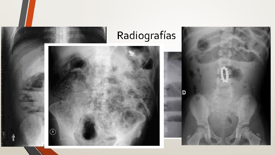 Radiografías 