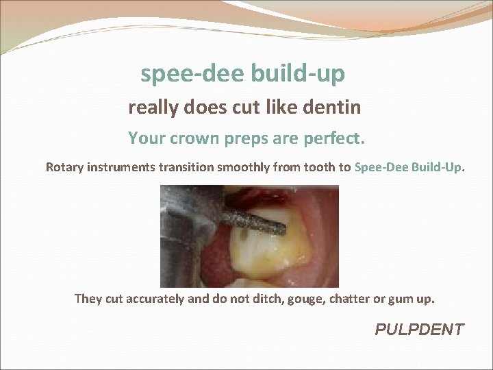 spee-dee build-up really does cut like dentin Your crown preps are perfect. Rotary instruments spee-dee build-up really does cut like dentin Your crown preps are perfect. Rotary instruments