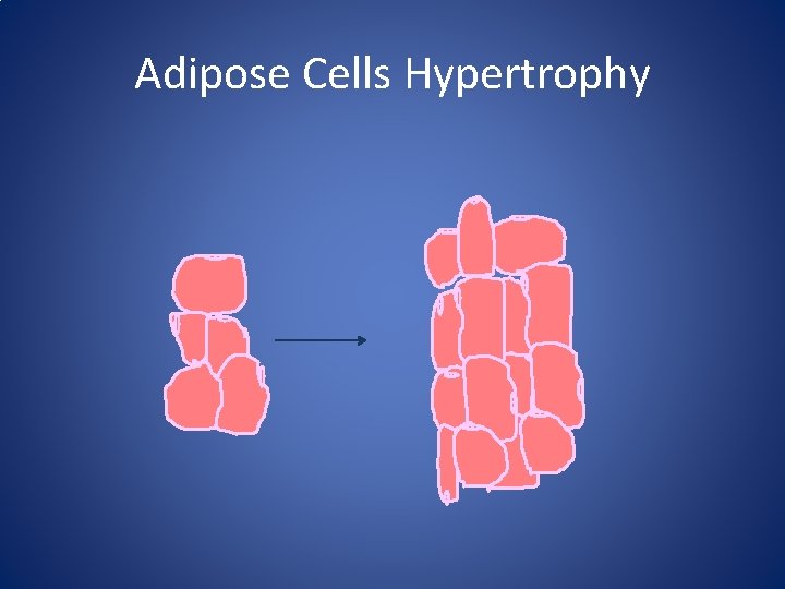 Adipose Cells Hypertrophy 