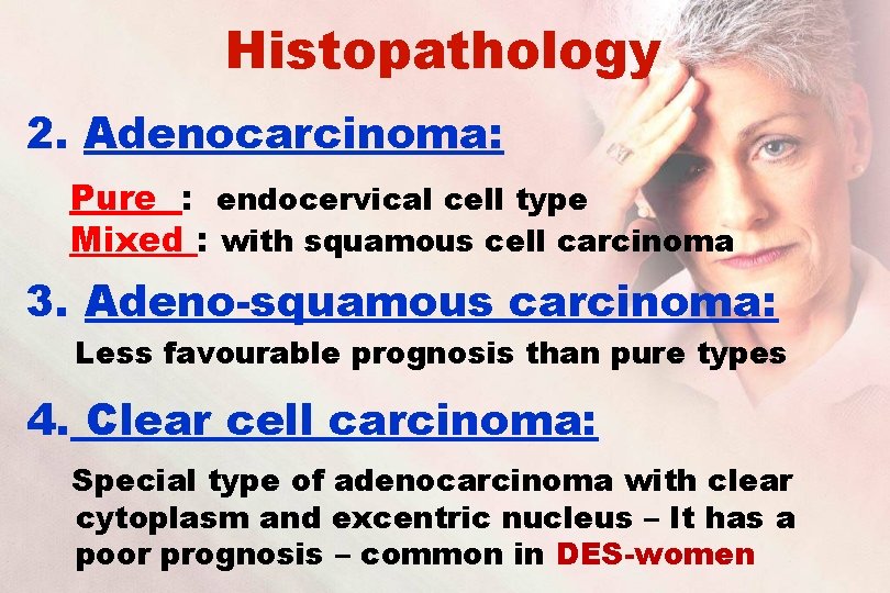 Histopathology 2. Adenocarcinoma: Pure : endocervical cell type Mixed : with squamous cell carcinoma