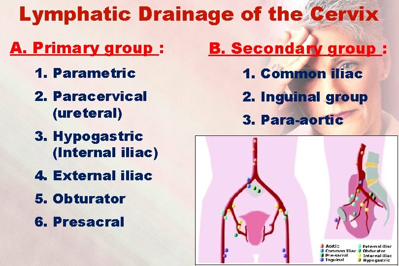 Lymphatic Drainage of the Cervix A. Primary group : B. Secondary group : 1.