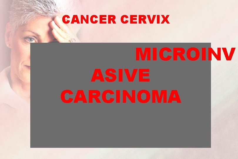 CANCER CERVIX MICROINV ASIVE CARCINOMA 