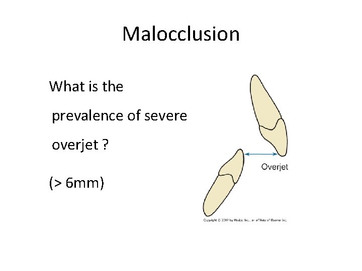 Malocclusion What is the prevalence of severe overjet ? (> 6 mm) 