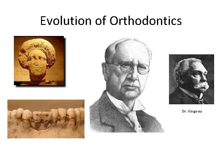 Evolution of Orthodontics 