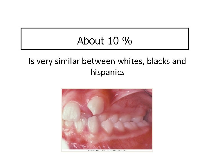 About 10 % Is very similar between whites, blacks and hispanics 