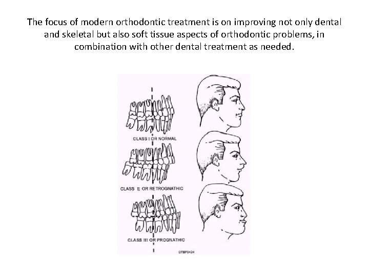 The focus of modern orthodontic treatment is on improving not only dental and skeletal