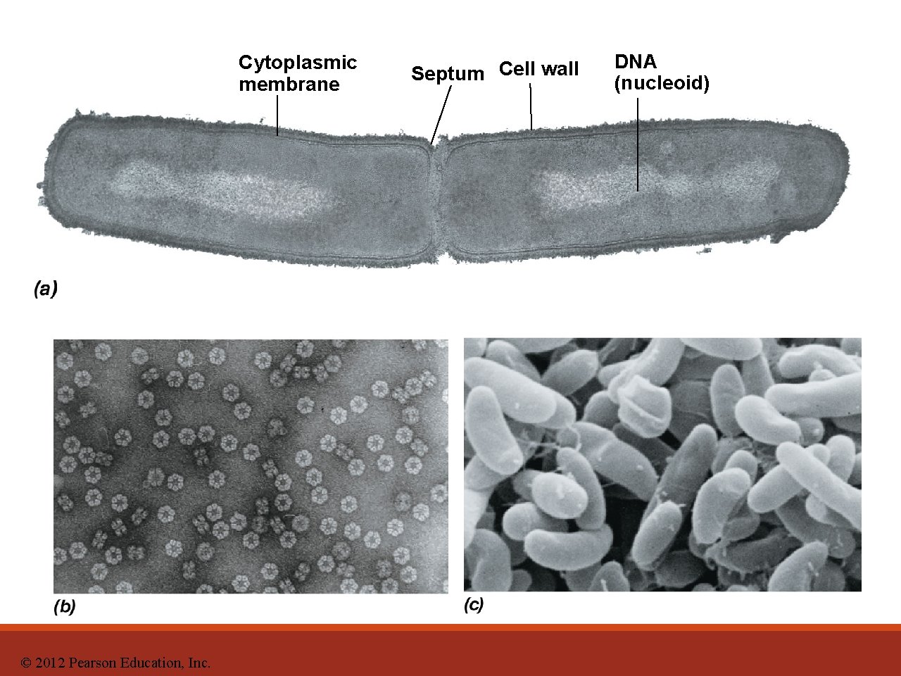 Cytoplasmic membrane © 2012 Pearson Education, Inc. Septum Cell wall DNA (nucleoid) 