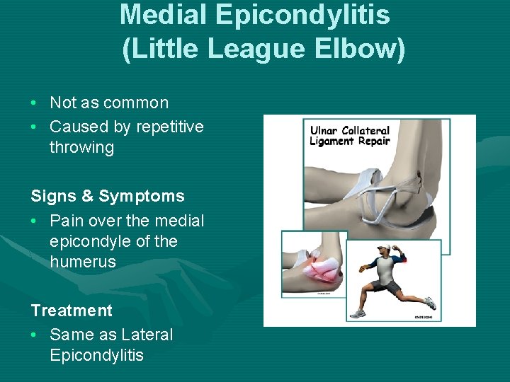 Medial Epicondylitis (Little League Elbow) • Not as common • Caused by repetitive throwing