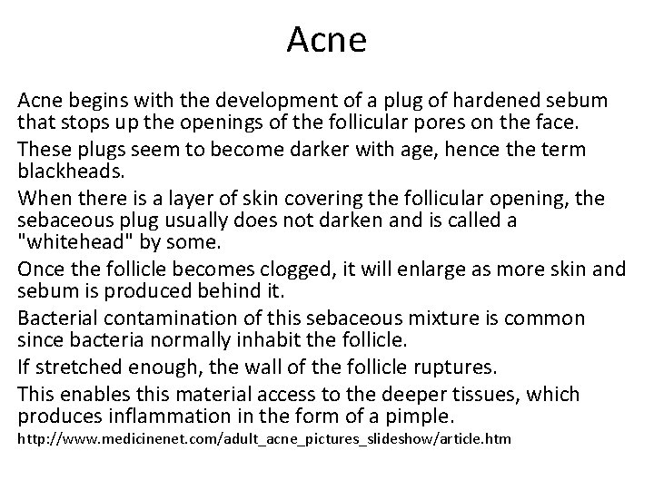 Acne begins with the development of a plug of hardened sebum that stops up