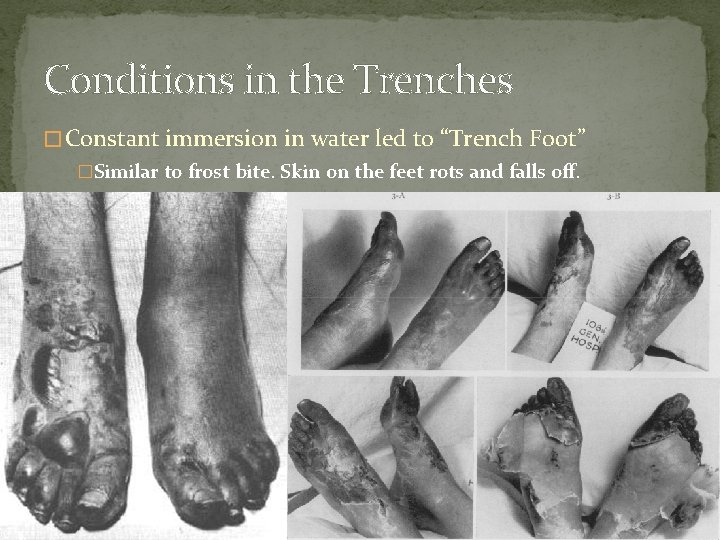 Conditions in the Trenches � Constant immersion in water led to “Trench Foot” �Similar Conditions in the Trenches � Constant immersion in water led to “Trench Foot” �Similar