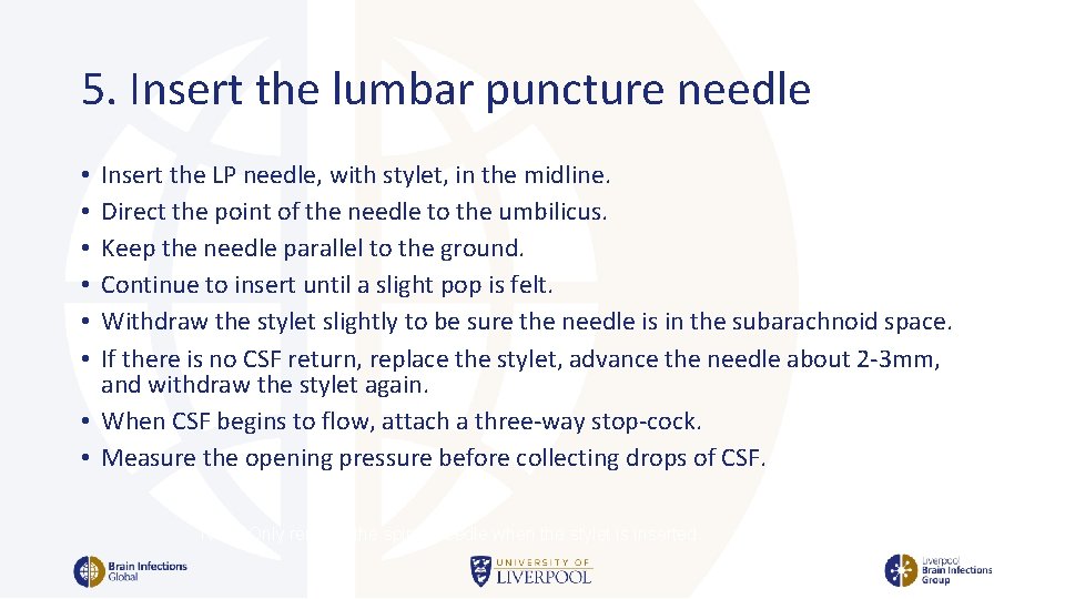 5. Insert the lumbar puncture needle Insert the LP needle, with stylet, in the