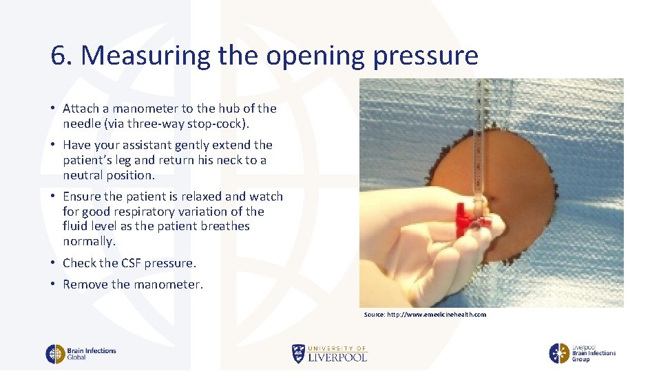 6. Measuring the opening pressure • Attach a manometer to the hub of the