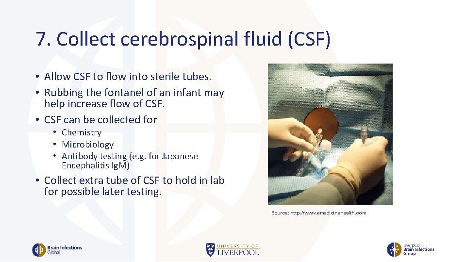 7. Collect cerebrospinal fluid (CSF) • Allow CSF to flow into sterile tubes. •