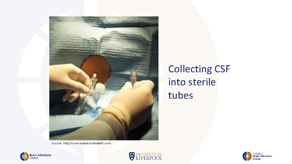 Collecting CSF into sterile tubes Source: http: //www. emedicinehealth. com 