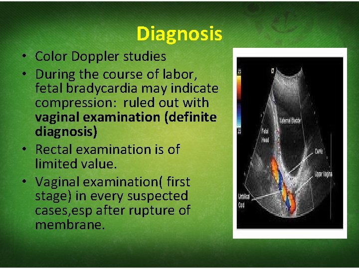 Diagnosis • Color Doppler studies • During the course of labor, fetal bradycardia may