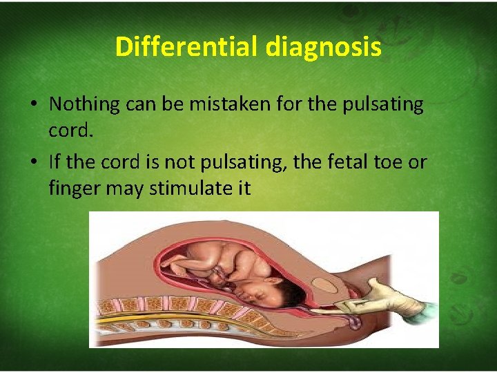 Differential diagnosis • Nothing can be mistaken for the pulsating cord. • If the