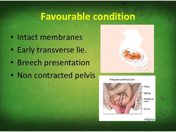 Favourable condition • • Intact membranes Early transverse lie. Breech presentation Non contracted pelvis