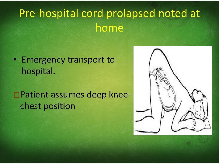 Pre‐hospital cord prolapsed noted at home • Emergency transport to hospital. �Patient assumes deep