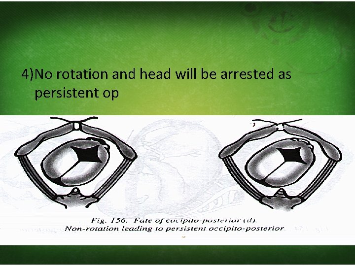 4)No rotation and head will be arrested as persistent op 