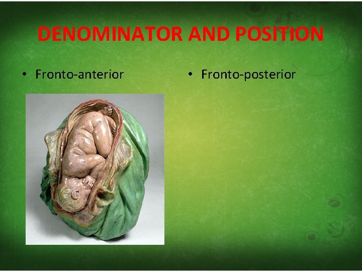 DENOMINATOR AND POSITION • Fronto‐anterior • Fronto‐posterior 