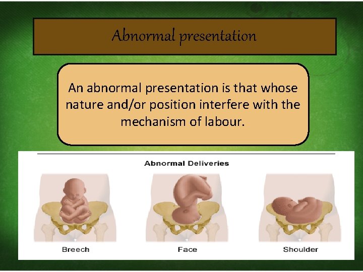 Abnormal presentation An abnormal presentation is that whose nature and/or position interfere with the