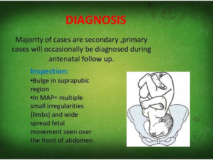 DIAGNOSIS Majority of cases are secondary , primary cases will occasionally be diagnosed during