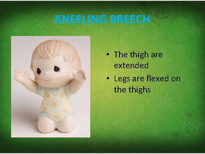 KNEELING BREECH • The thigh are extended • Legs are flexed on the thighs