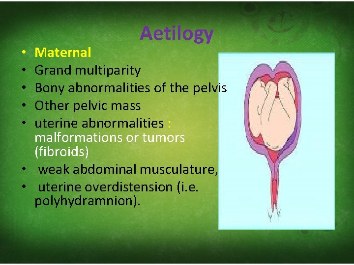 Aetilogy Maternal Grand multiparity Bony abnormalities of the pelvis Other pelvic mass uterine abnormalities