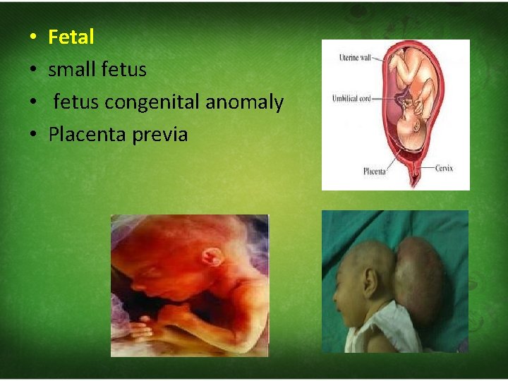  • • Fetal small fetus congenital anomaly Placenta previa 