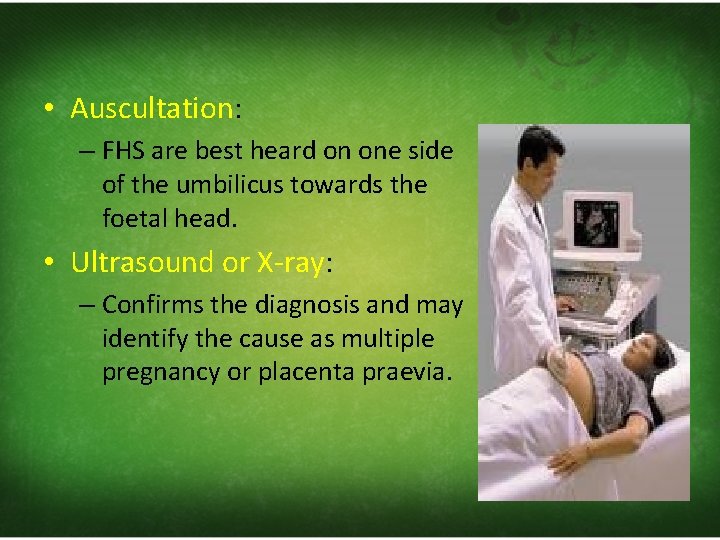  • Auscultation: – FHS are best heard on one side of the umbilicus
